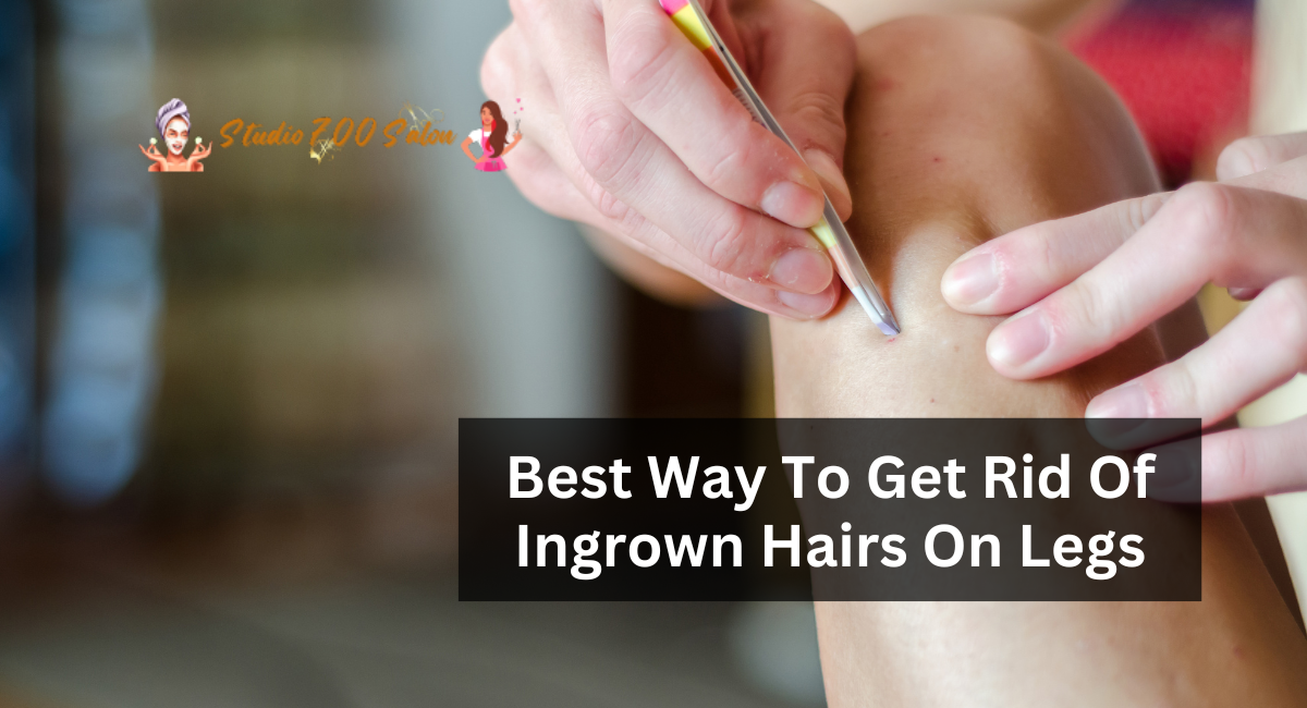 Best Way To Get Rid Of Ingrown Hairs On Legs