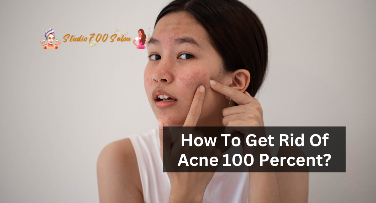 How To Get Rid Of Acne 100 Percent?